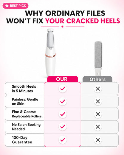 Jynvre Pedicure Callus Silk 3 Pro