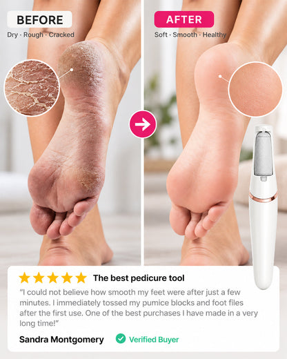 Jynvre Pedicure Callus Silk 3 Pro